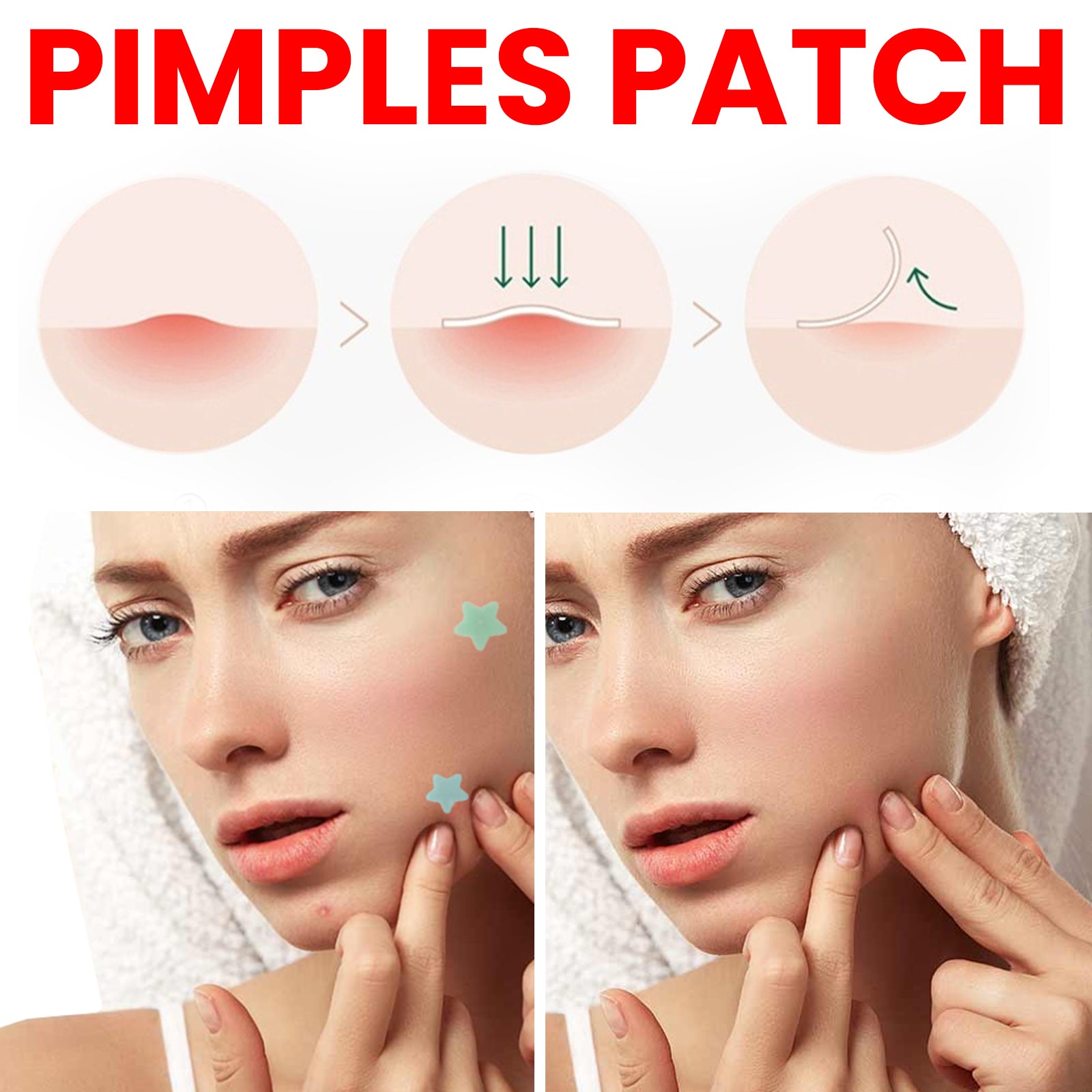 Jaysuing Star Colored Acne Stickers Repair Acne Pits & Marks Fade Acne Spots Blemishes Cover Acne Pimples