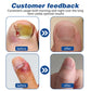 Dobshow™ Herbal Formula Fungal Nail Paronychia Treatment Gel
