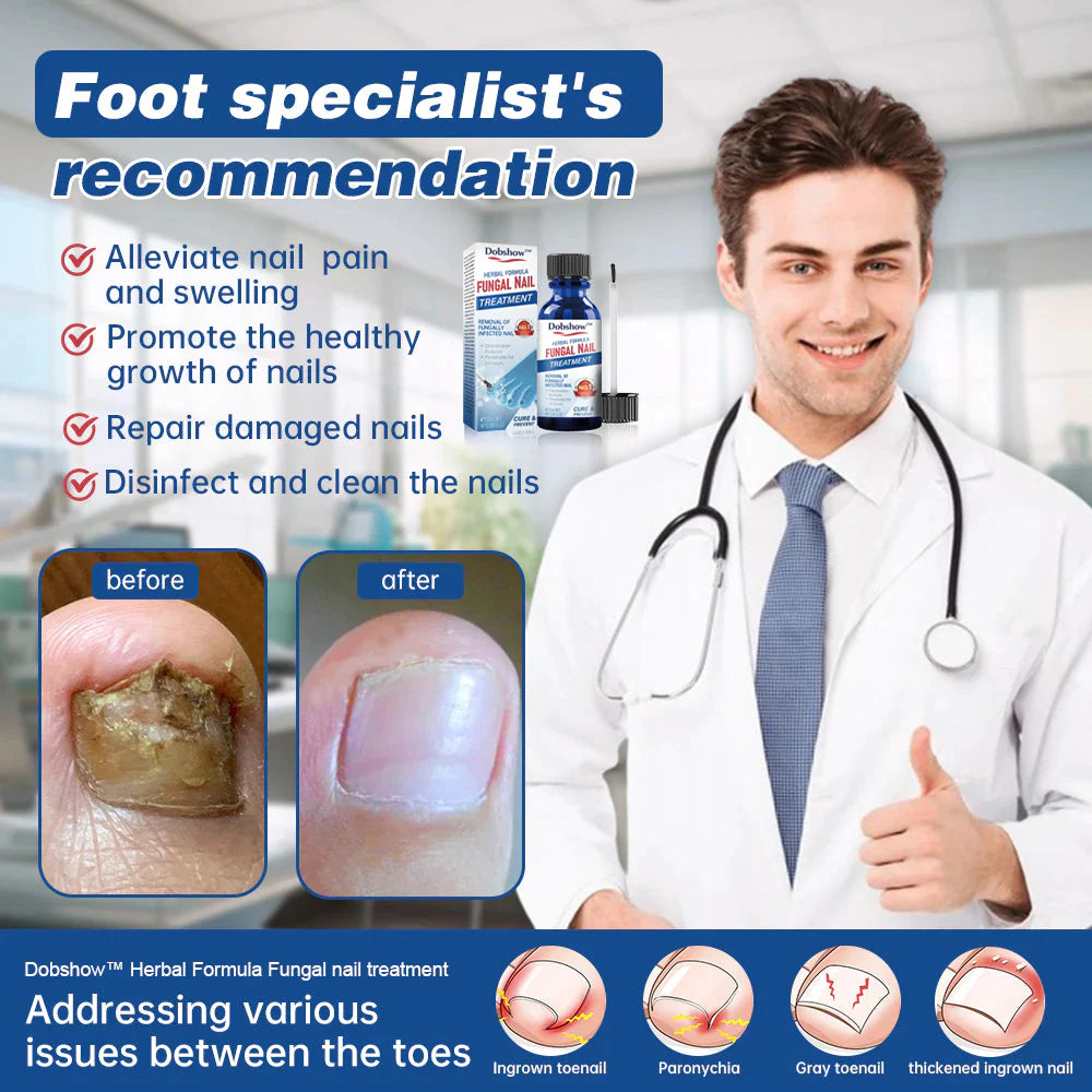 Dobshow™ Herbal Formula Fungal Nail Paronychia Treatment Gel