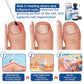 Dobshow™ Herbal Formula Fungal Nail Paronychia Treatment Gel